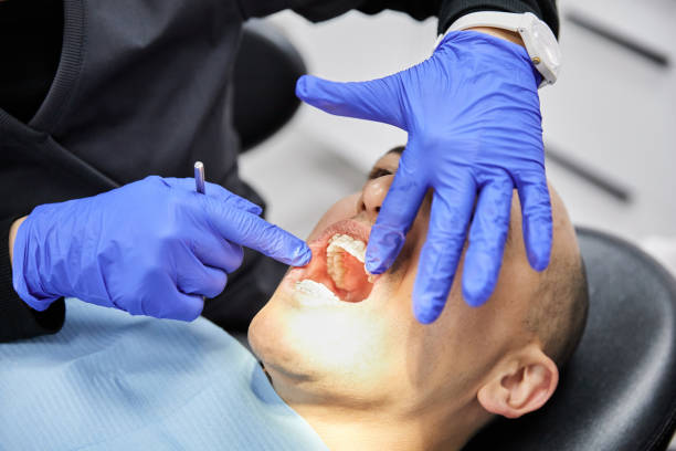 Best Emergency Broken Tooth Repair in Mountainair, NM